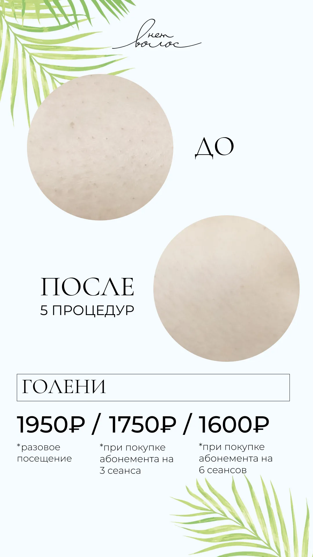 Голени