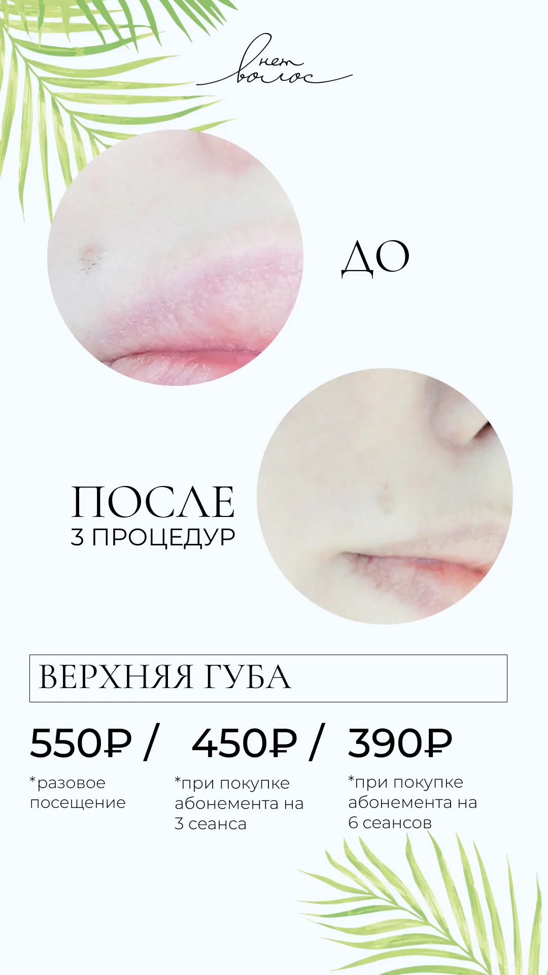Верхняя губа