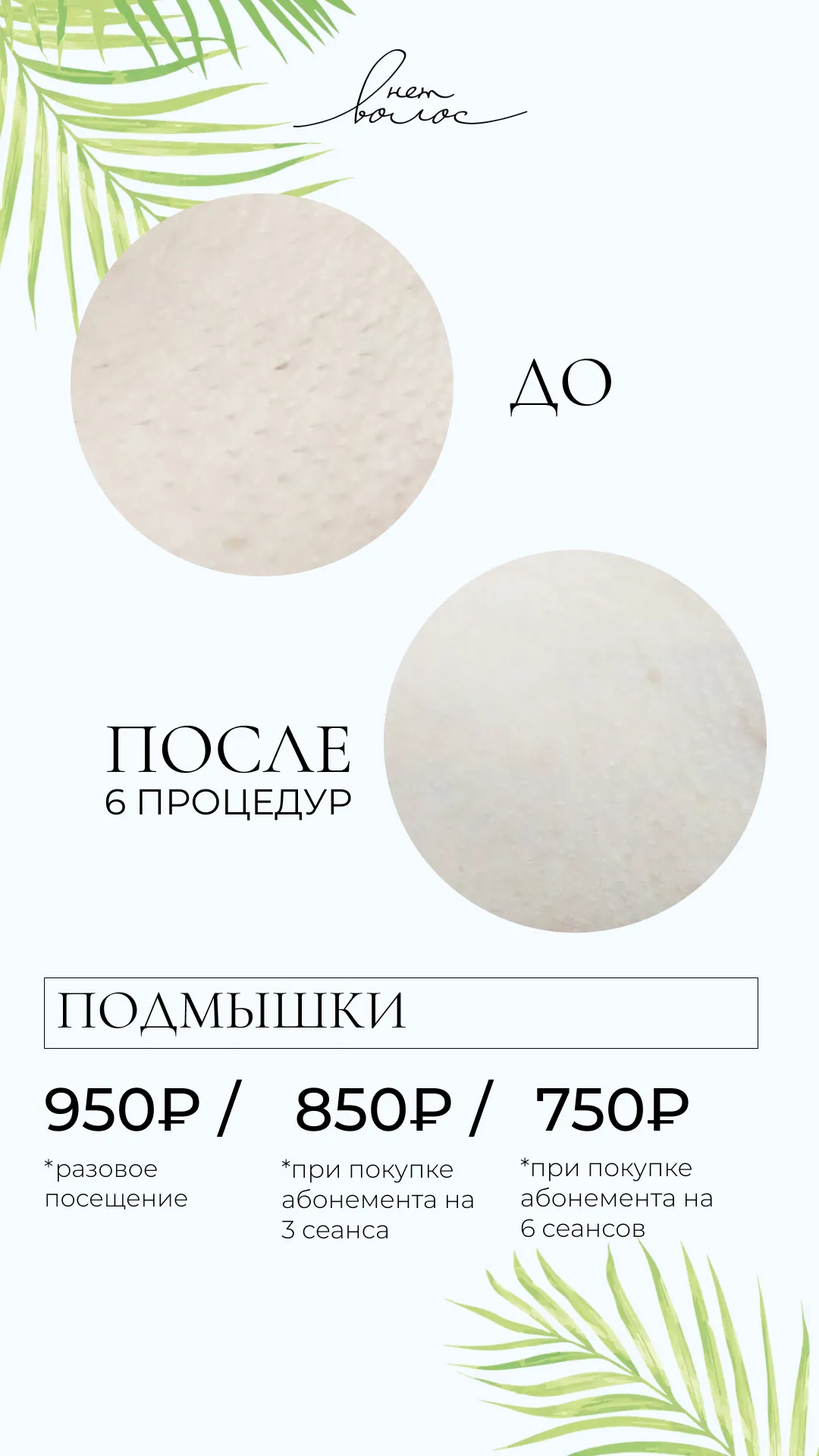 Подмышки